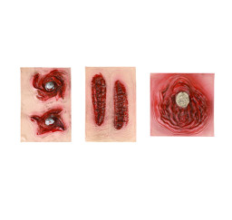 Samolepící jizvy 197787 Rappa